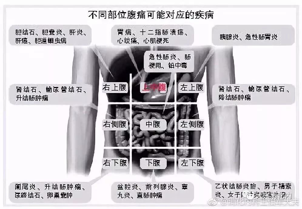 正确描述腹痛部位很重要